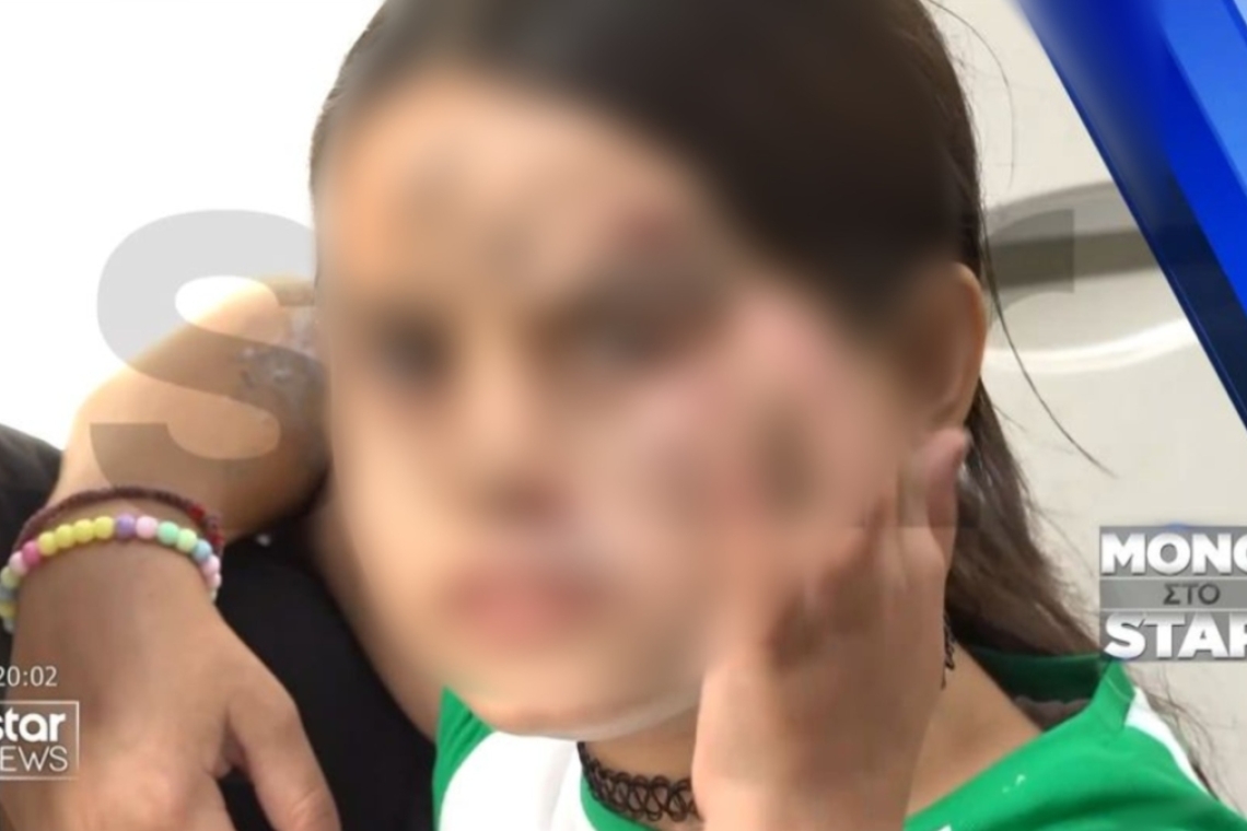 https://www.parapolitika.gr/images/640x360/jpg/files/2025-09-12/sepolia-apagogi-koritsi.jpg