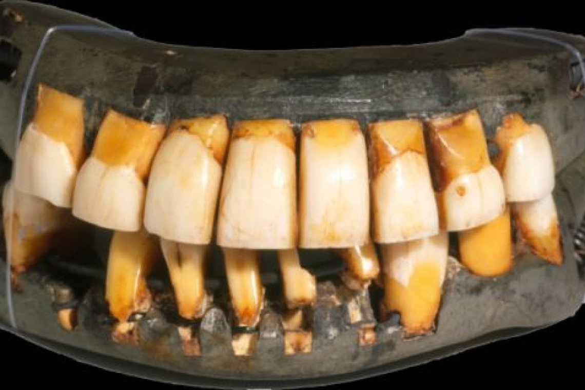 Ο άνθρωπος που άκουγε με τα δόντια του