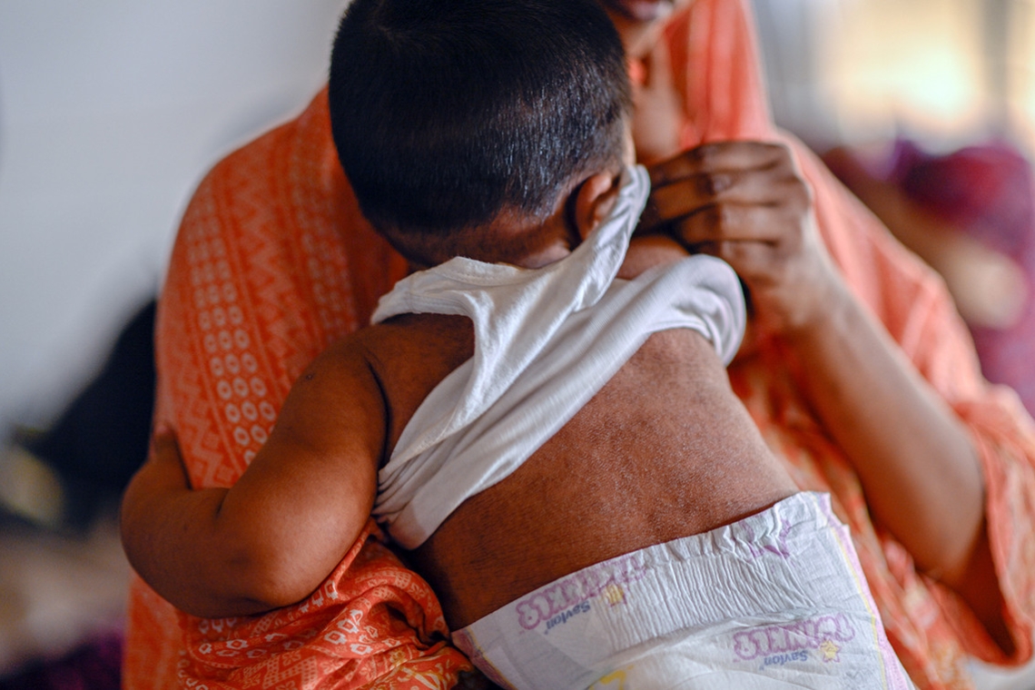 https://www.in.gr/wp-content/uploads/2026/05/bangladesh-measles-620x350.jpg